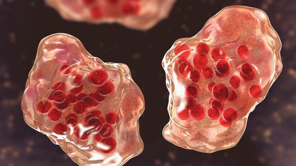 Central Minnesota county reports "several cases of suspected measles" — WCCO / CBS Minnesota, Richfield Health news