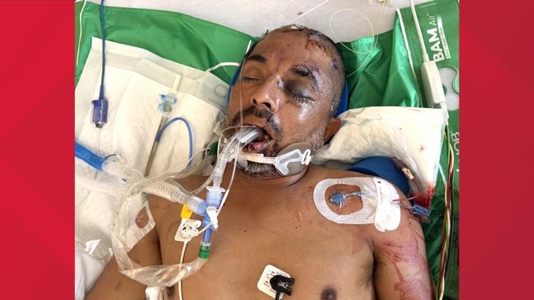 University Hospital asks for help identifying unconscious patient hit by truck Saturday evening — KENS 5 (San Antonio), Richfield Health news